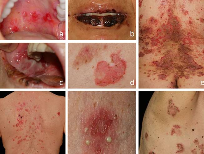 Skin Diseases and Venereology