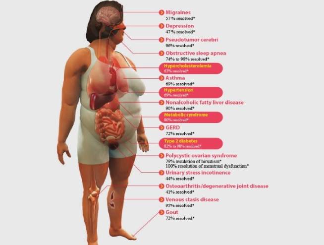 Over Weight treatment